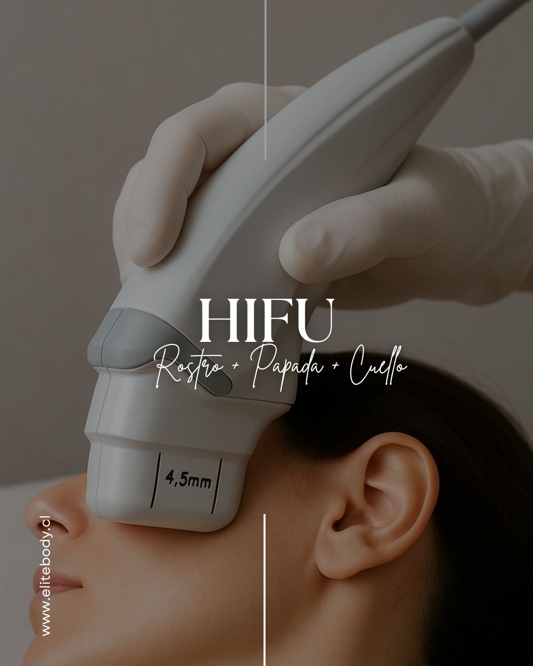 HIFU FACIAL (ROSTRO + PAPADA + CUELLO)