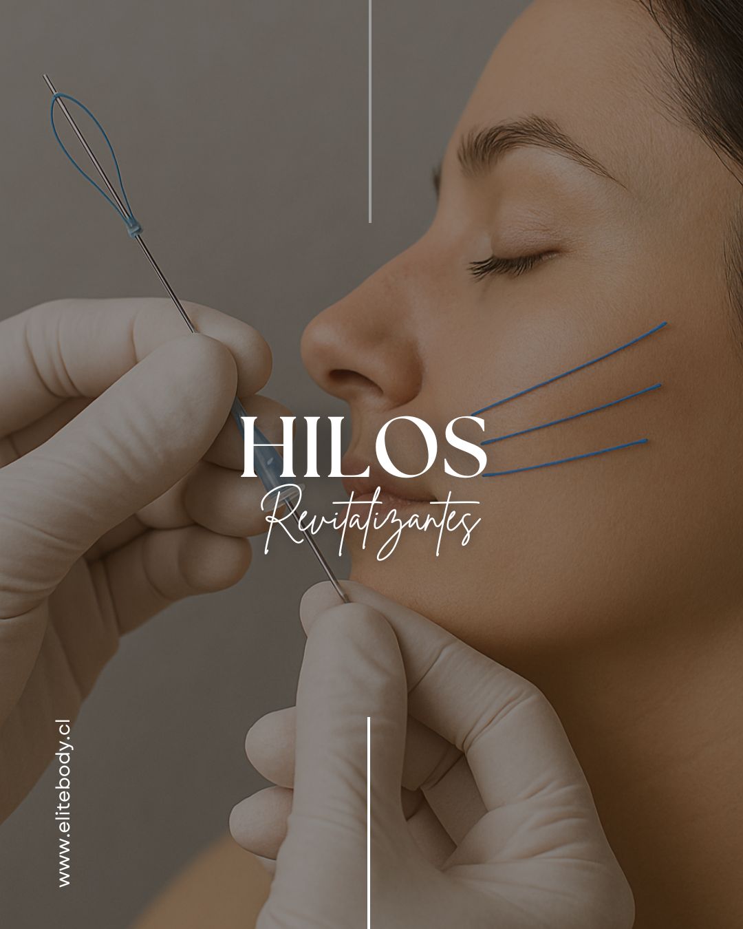 Hilos para revitalizar