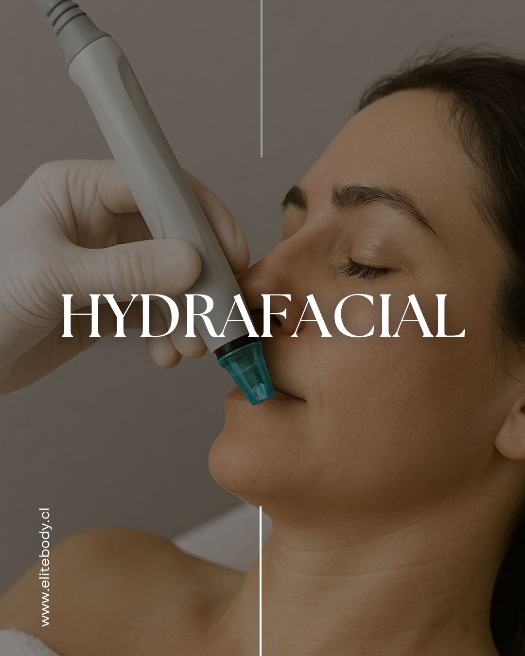 HYDRAFACIAL