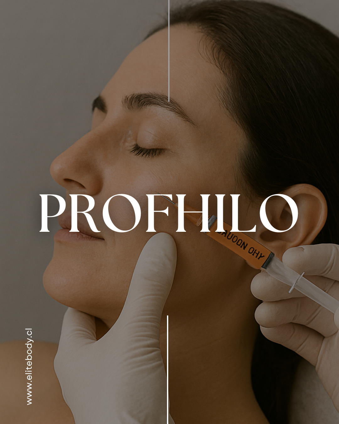 Profhilo FACE